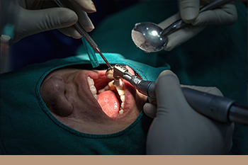 BClinic - Dental Clinic - Services - جراحات الفك التصحيحية 