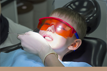 BClinic - Dental Clinic - Services - Silver Diamine Fluoride (SDF) 