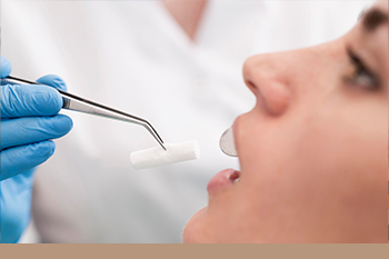 BClinic - Dental Clinic - Services - استخراج جراحي لضروس العقل والأسنان المتضررة